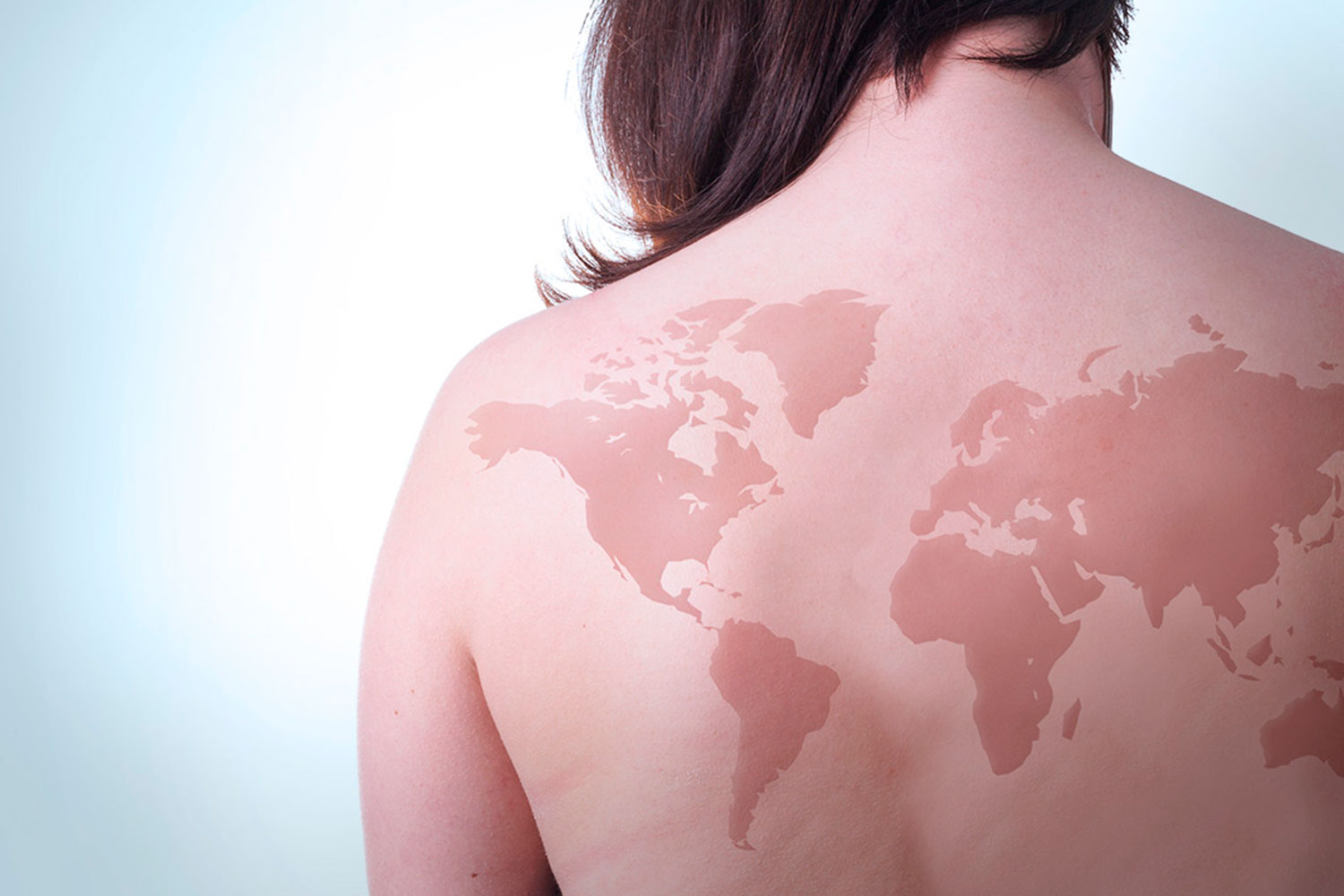 Día mundial de lucha contra la lepra