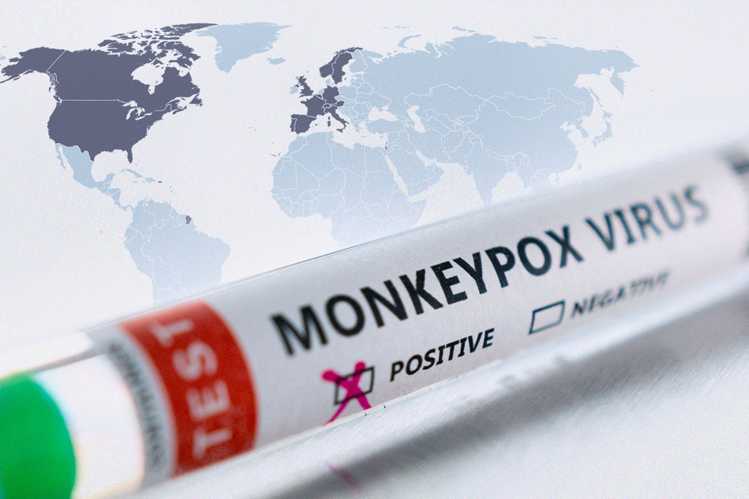 ¿Qué es la viruela del mono o mpox? ¿Cuáles son sus síntomas? ¿Cómo se propaga?