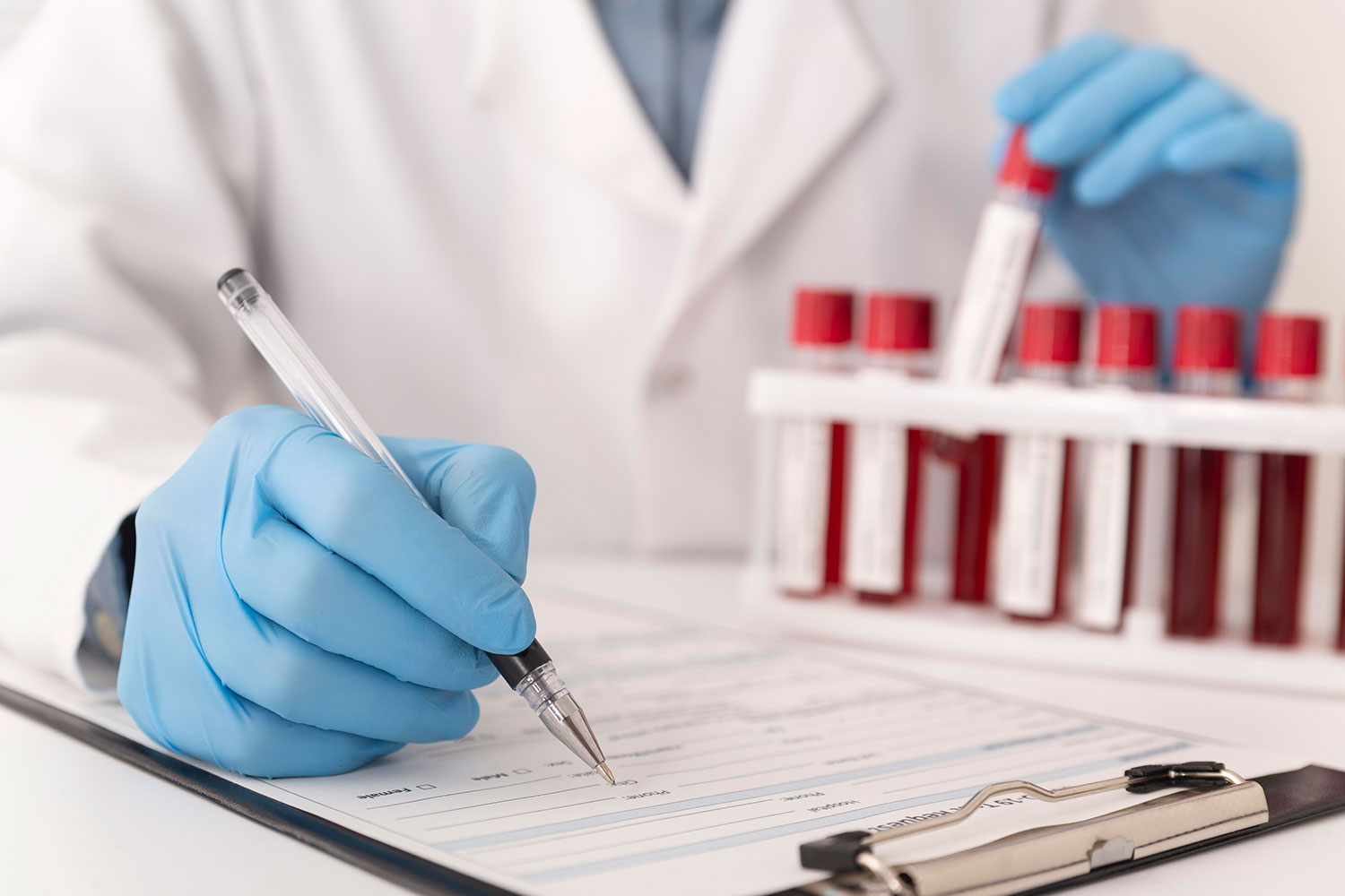 La simple prueba con la que puedes detectar hasta dieciocho tipos de cáncer en tu cuerpo