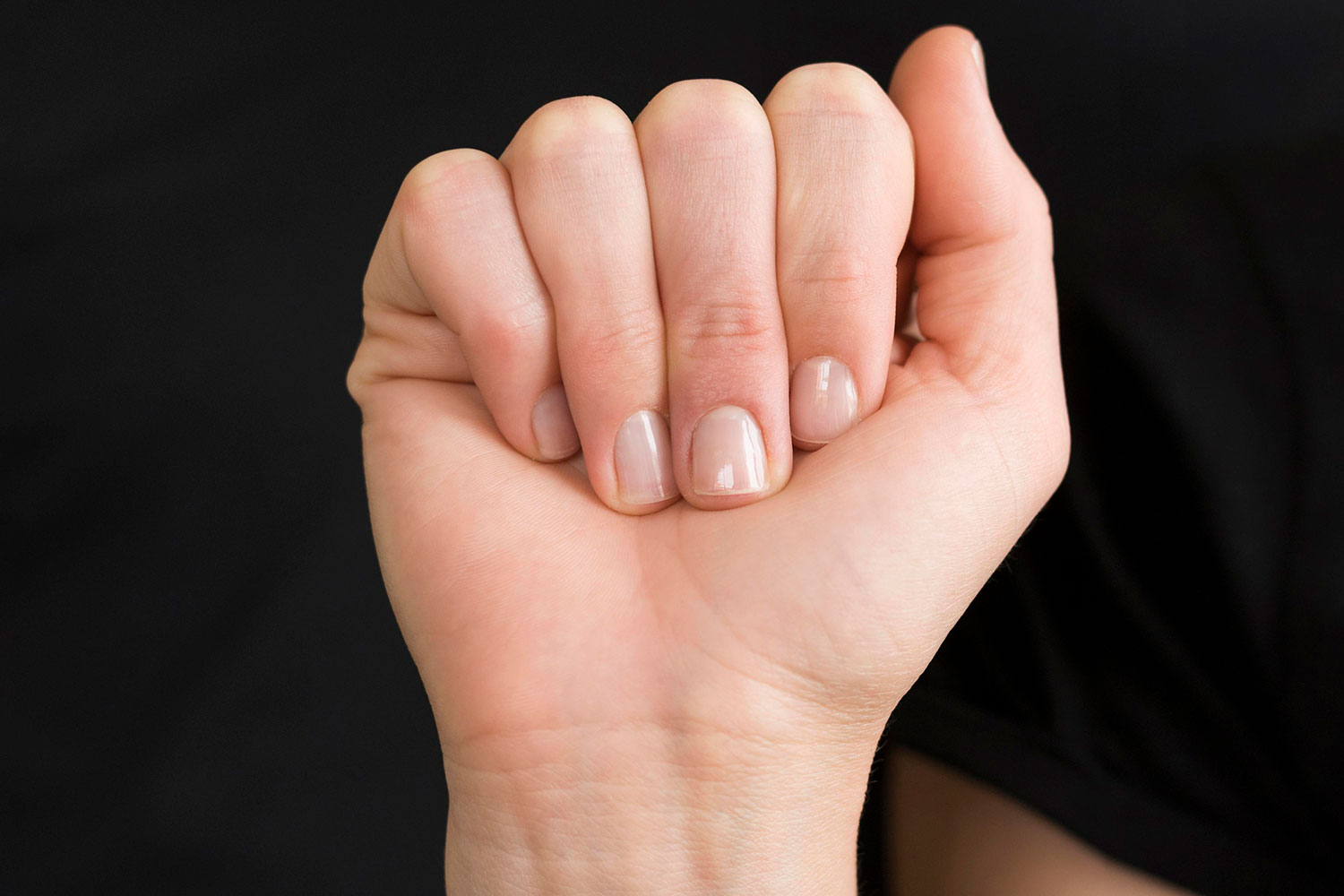 ¿Qué significa tener una raya en la uña? Estos datos sorprendentes cambiarán tu percepción sobre la salud