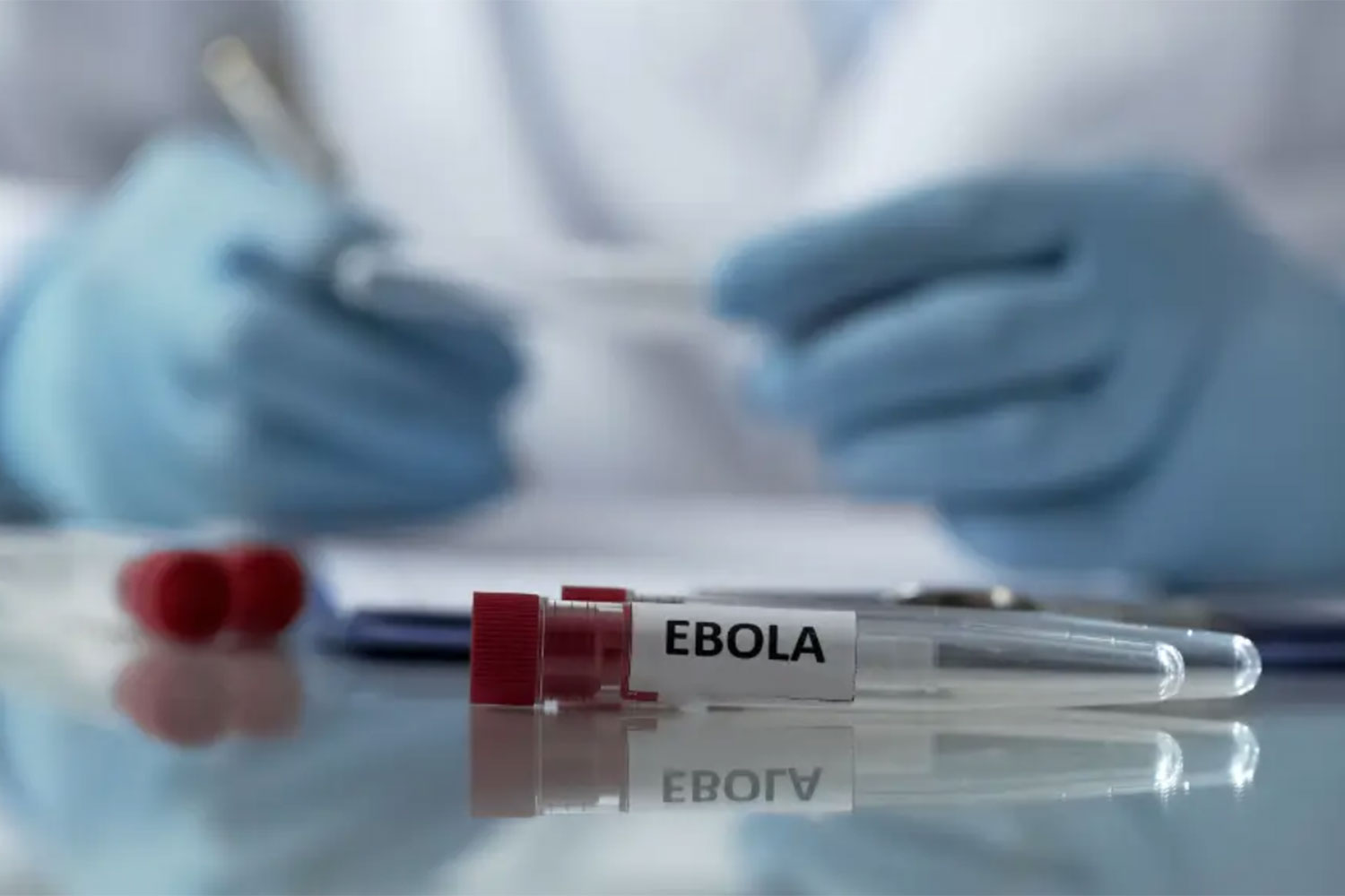 Una pastilla cura el ébola en monos: esperanza de tratamiento para humanos